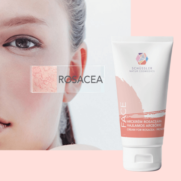 Rosacea krém rosaceára hajlamos bőrre